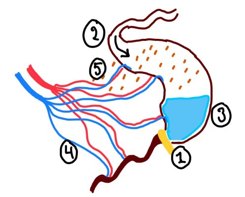 Problemerne forbundet med ileus. (1) tarmen obstrueres, her illustreret ved en adhærence, (2) proksimale organer fortsætter væskesekretion, patienten sluger luft, (3) væske og luft akkumulerer og øger det intramurale tryk i tarmen proksimalt for obstruktionen og distalt for obstruktionen klapper tarmen sammen (4) det venøse tilbageløb bliver blokeret, subsidiært det arterielle tilløb, og der opstår risiko for tarmiskæmi, (5) bakterier translokeres fra tarm til kredsløb. Med inspiration fra Jacobs (2022).